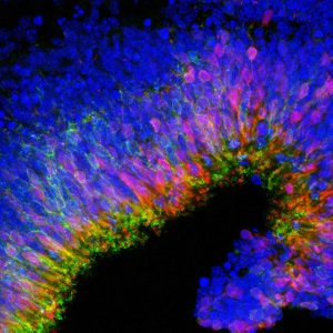 stem cells grown to form retina